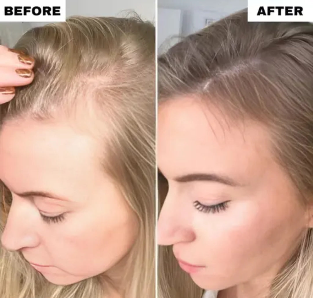 Rechargeable 360° Electric Scalp Massager | Stress Relief & Hair Growth Tool with Detachable Kneading Heads